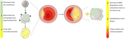 Molecular and Nonmolecular Imaging of Macrophages in Atherosclerosis